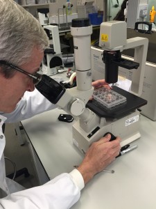 Dr Williams shows us some myeloid cancer cells under the microscope, before and after treatment in the Tissue Culture Lab. The Tissue Culture Lab is where the scientists grow cancer cells outside of people 