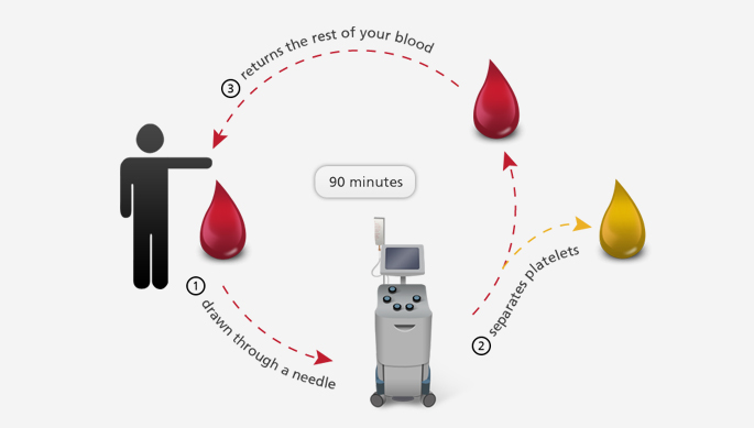 Platelet donation process