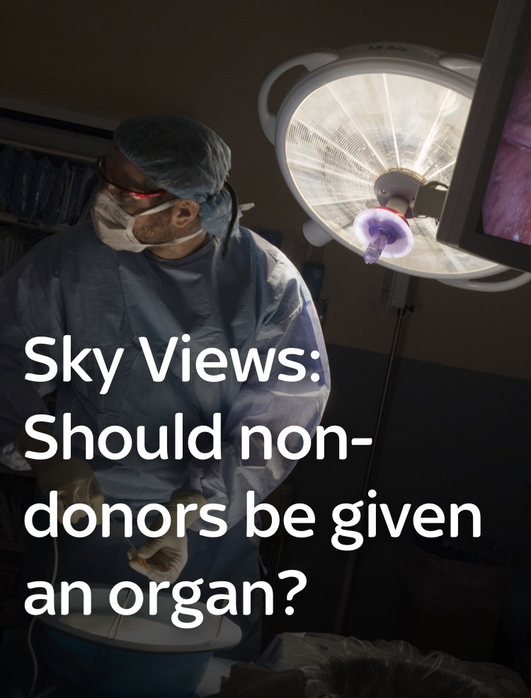 “Should non-donors be given an organ ?”
